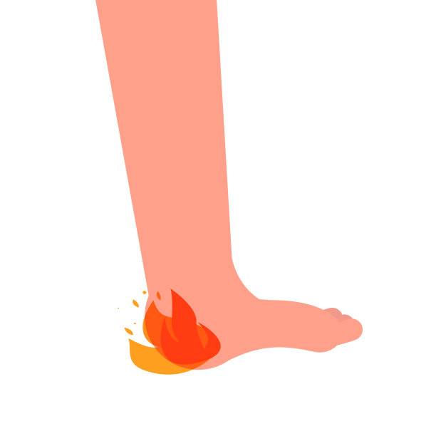 脚后跟刺痛，疼痛，灼烧感。矢量插图。图片下载