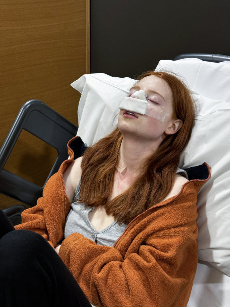 特写照片中，迷人的红发女性穿着休闲服装，仰卧在康复室的床上，靠在枕头上，闭着眼睛，鼻中隔成形术(鼻中隔偏曲手术和鼻子整形)后，纱布包扎在鼻子上，重点放在前景图片下载