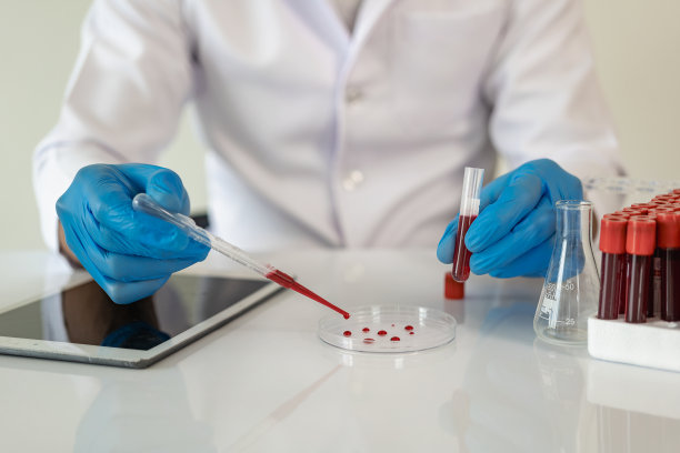 亚洲血液学家检查医学上必要的血液检查根据医疗保险指南由医生订购，尝试诊断血液检查，实验室服务特写图片图片下载