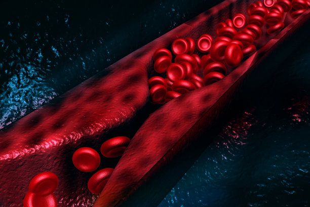 动脉阻塞的科学背景图片下载