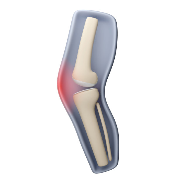 膝关节疼痛孤立白色背景图片下载