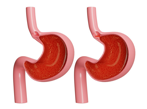 3d渲染胃和胃酸回流图片下载