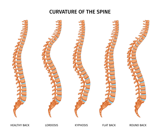脊柱曲度解剖套装图片下载