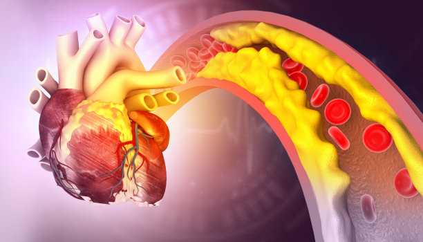 动脉阻塞的人类心脏图片下载
