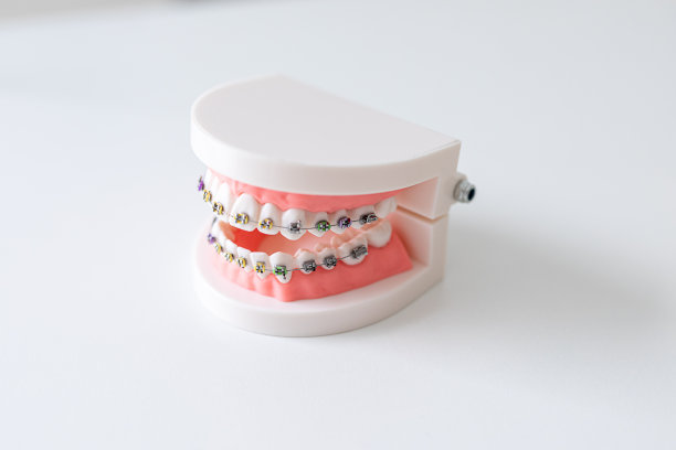 带牙套和假牙的塑料牙科模型图片下载