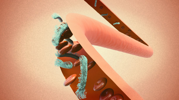 血流，静脉和红细胞以及败血症的存在图片下载