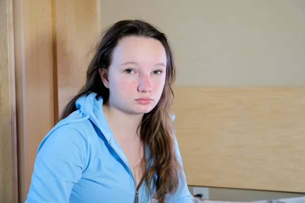 年轻女子皮肤发痒，抓挠痒的地方。对昆虫叮咬、皮炎、食物、药物过敏。医疗保健理念。过敏皮疹图片下载