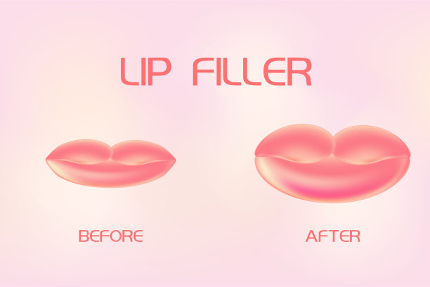 前唇填料，后背景。唇部注射玻尿酸。美容诊所概念。矢量图图片下载