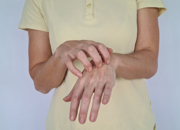 一个女人在挠她的手图片下载