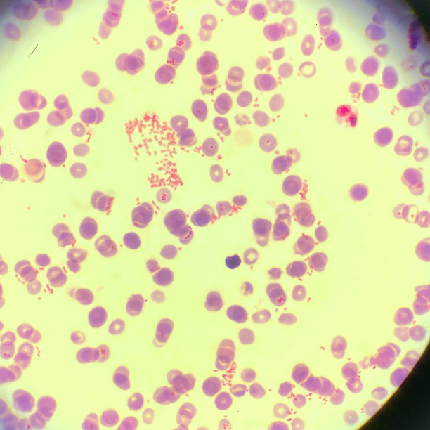 脓毒症涉及血液中检测到的耐多药肠杆菌图片下载