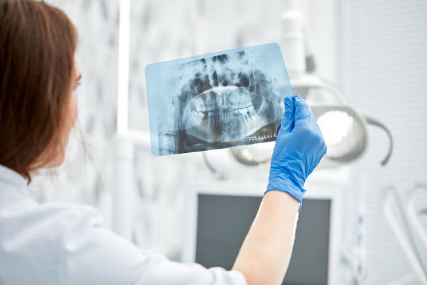 女医生拿着并看着牙科x光片图片下载