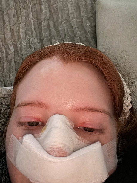特写照片中，迷人的红发女性戴着颈枕躺在床上，鼻中隔成形术后(鼻中隔偏曲手术和鼻子整形)，纱布绷带和点滴垫在鼻子上，重点放在前景图片下载