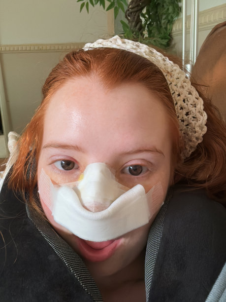 特写照片中，迷人的红发女性戴着颈枕躺在沙发上，鼻中隔成形术后(鼻中隔偏曲手术和鼻子整形)，纱布绷带和点滴垫在鼻子上，重点放在前景上图片下载