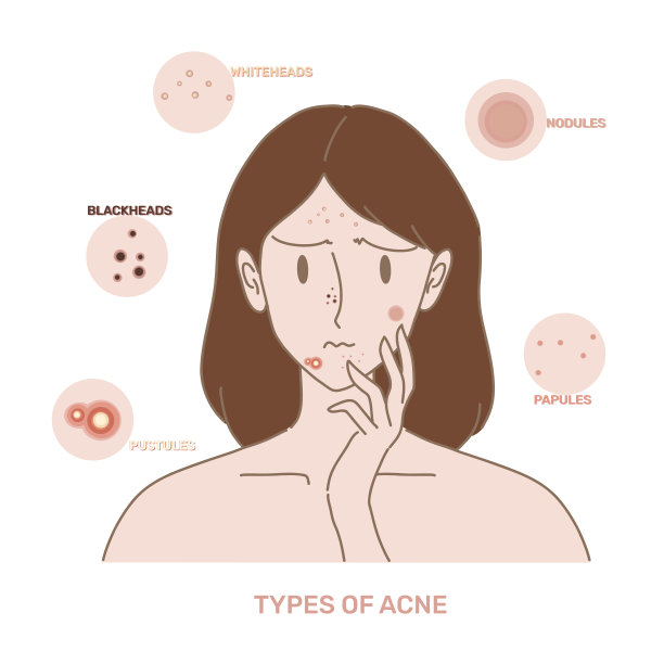 脸上长粉刺的悲伤女人。女孩用手摸脸。手绘平面卡通人物矢量插图。图片下载