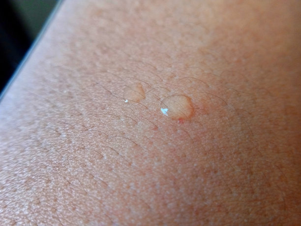 皮肤表面的两个水滴的照片图片下载