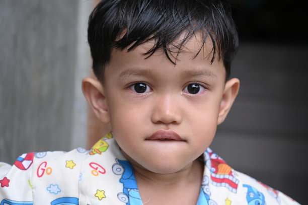 一个患有眼疾的孩子的画像图片下载