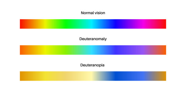 Deuteranomaly和deuteranopia图片下载