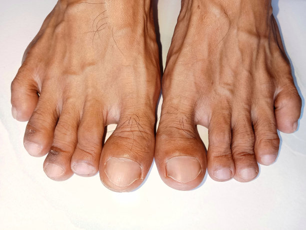 罕见的脚趾图片下载