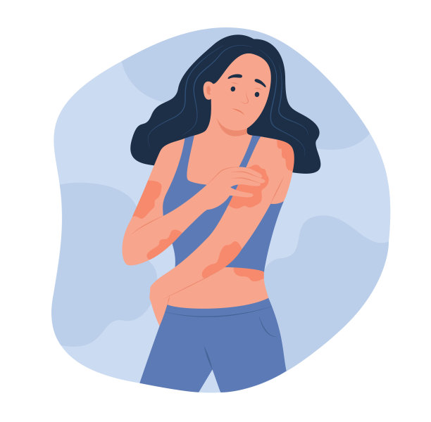女人看湿疹的身体皮肤病学概念插图图片下载
