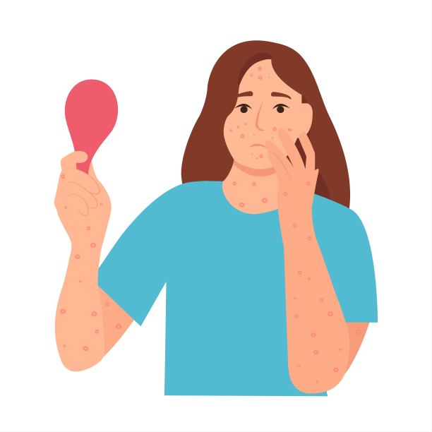 女人得了水痘。图片下载