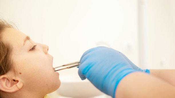 近距离剪裁的照片治疗愈合操作牙齿牙齿，填补口腔防止龋齿蛀牙牙医在牙科诊所正畸。口腔学的概念。图片下载