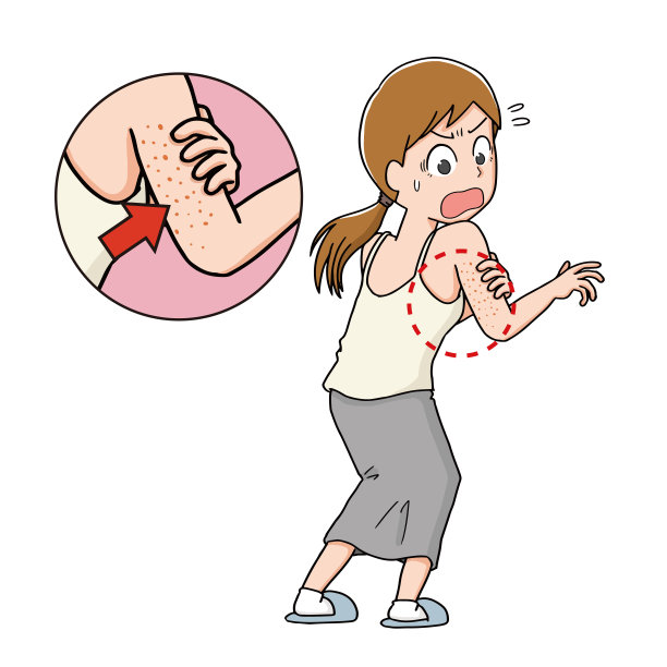 上臂皮肤粗糙的图示图片下载