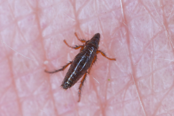 跳蚤咬人的手，喝人的血。家畜和人类讨厌的寄生虫。致病微生物的携带者图片下载