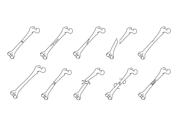 骨折线图标集。向量孤立元素。图片下载