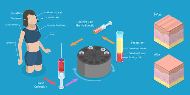三维等距平面矢量概念说明的PRP程序图片下载