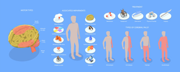 脑瘫的三维等距平面矢量概念图图片下载