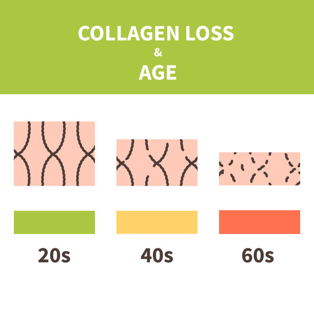 胶原蛋白损失和皮肤老化细胞信息图图片下载
