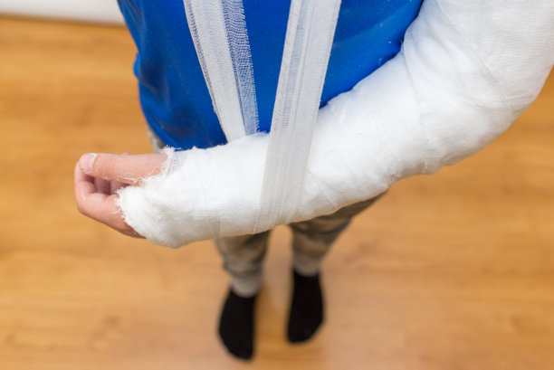 儿童手肘夹板意外骨折。孩子在家里，上面的照片，特写。图片下载