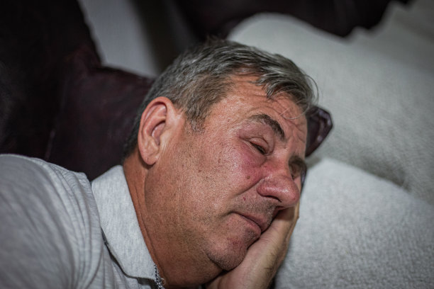 男性脸部眼皮红肿，虫咬过敏图片下载