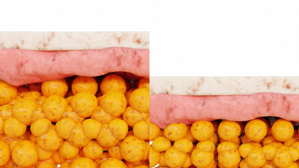 减肥比较。人的身体蜕变。之前和之后的粗腰和细腰，胖肚子之前和苗条贴合完美腹肌之后的快速减肥过程。在皮肤上。脂肪燃烧，3d渲染图片下载