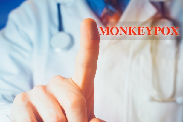 医生说病毒是猴痘图片下载