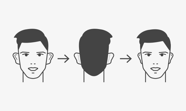 耳廓成形术线图标集。男性耳型改变。整形手术矫正。耳朵畸形的整容手术。矢量图图片下载