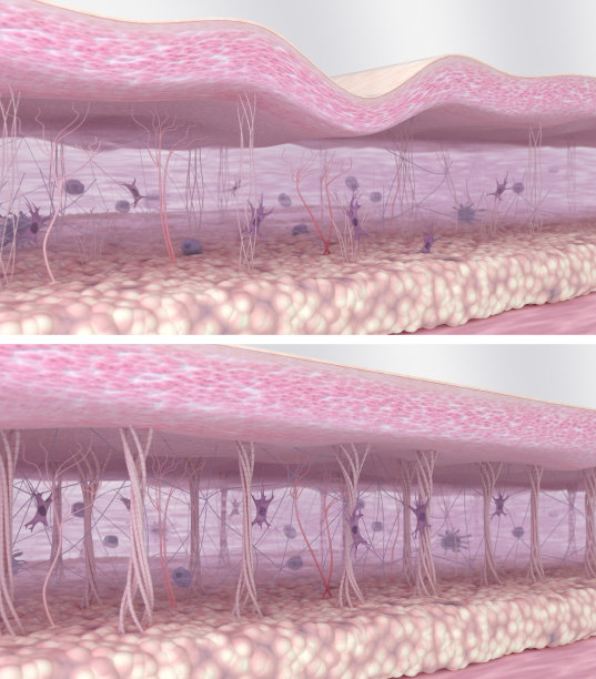 年轻和年老皮肤的3D插图对比图片下载
