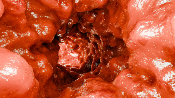 肠结直肠，结肠摆动，阴道肌肉运动，盆底解剖，盆底肌肉，盆腔器官脱垂，凯格尔运动，肠炎性肠病，结肠镜，3d渲染图片下载