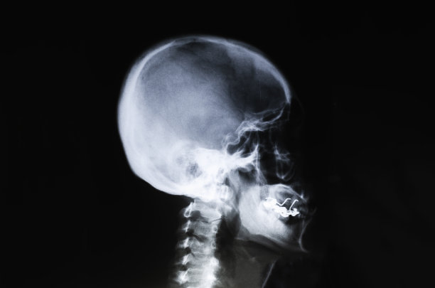 医生在医院检查病人的x光片。图片下载