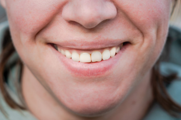 笑的女人的嘴和牙齿的特写照片图片下载