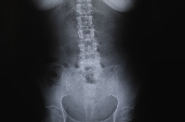 医生在医院检查病人的x光片。图片下载