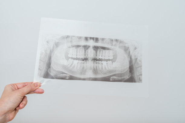 颌骨x线片透视。病人有牙齿的口腔x光片图片下载