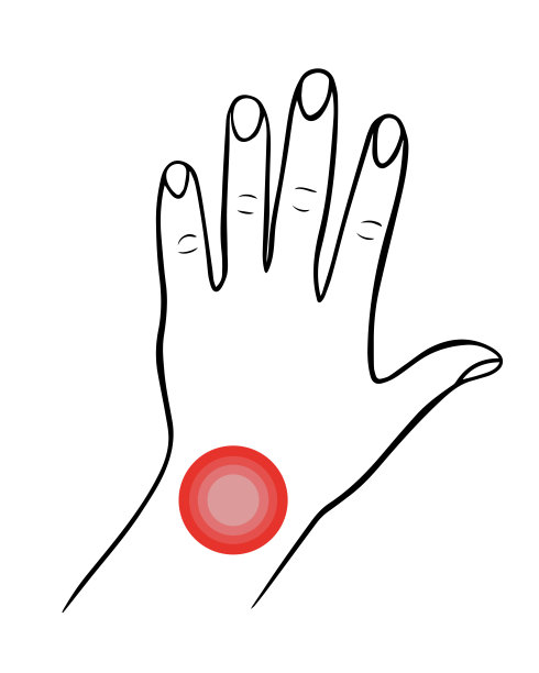 矢量孤立说明手腕疼痛。图片下载