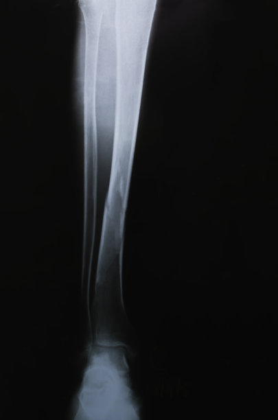 医生在医院检查病人的x光片。图片下载