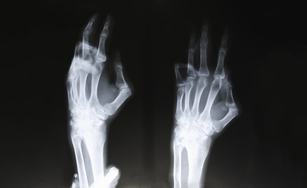 医生在医院检查病人的x光片。图片下载