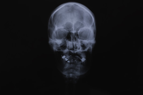 医生在医院检查病人的x光片。图片下载