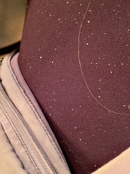 头皮屑图片下载