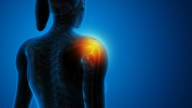 女性肩部疼痛图片下载