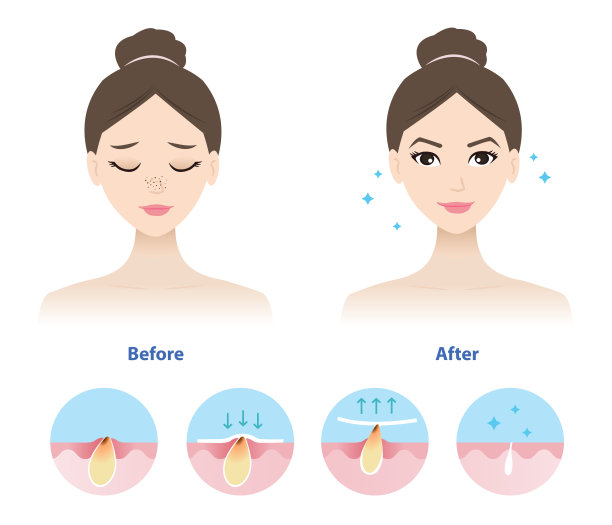 202405-去除黑头前后图片下载