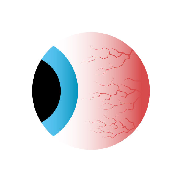 红眼侧视图。疾病压力，睡眠失眠障碍，毛细血管和瞳孔。矢量插图。图片下载